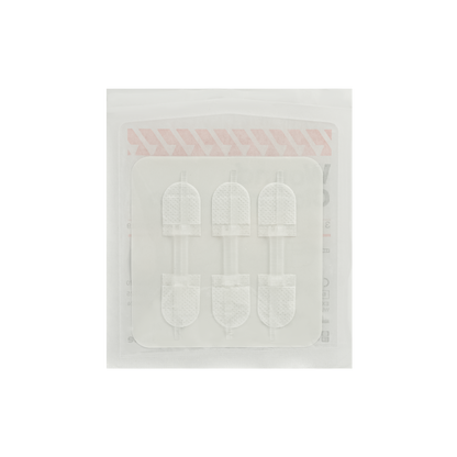 Wound Closure Device
