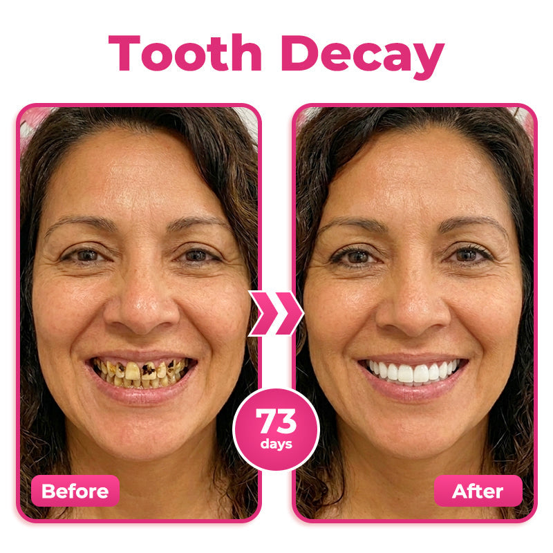 Thismile NH-10 Enamel & Gum Advanced Therapy Toothpaste Serum