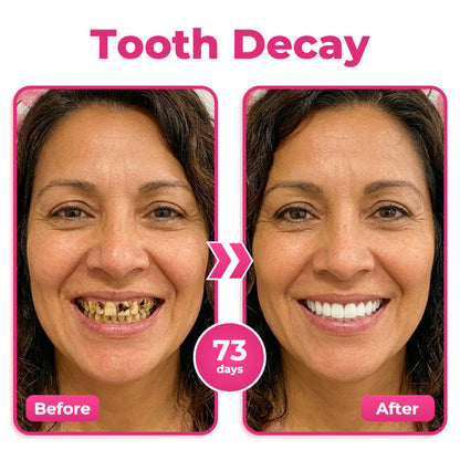 Thismile NH-10 Enamel & Gum Advanced Therapy Toothpaste Serum