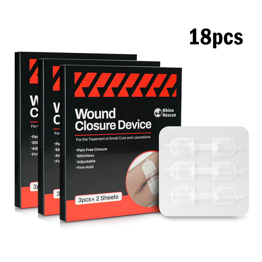 Wound Closure Device