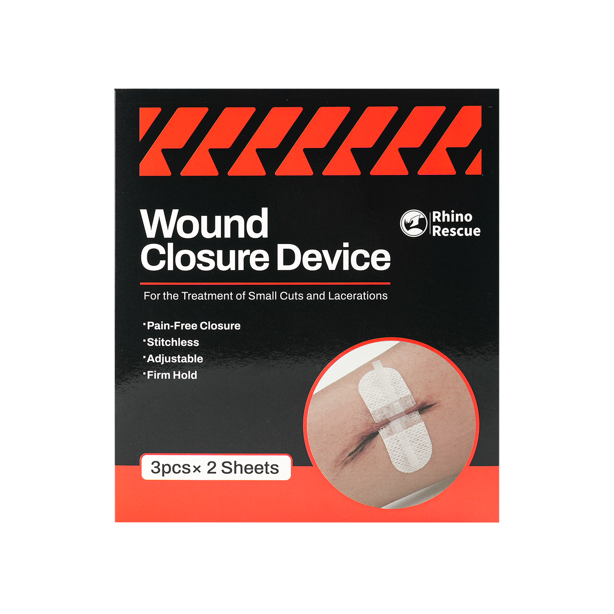Wound Closure Device