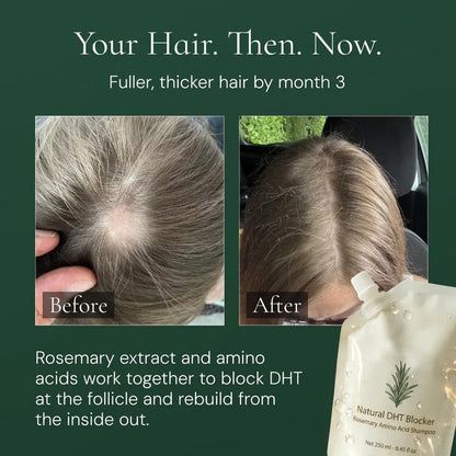 Rosemary Hair Growth Shampoo
