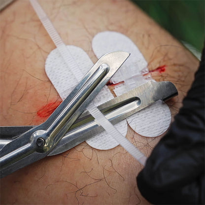 Wound Closure Device