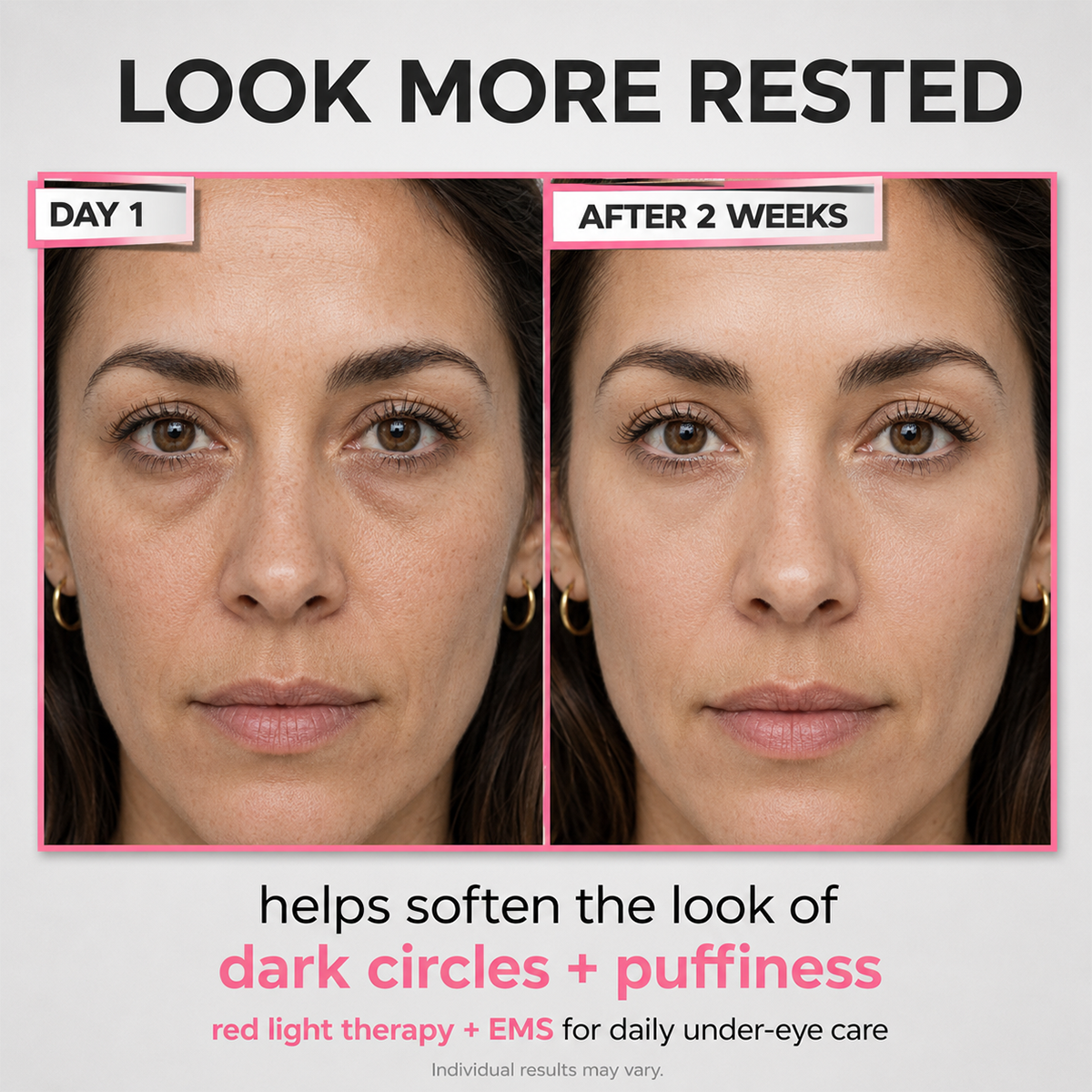 Under-Eye Red Light Beauty Device – Gentle LED Eye Care for Tired-Looking Eyes