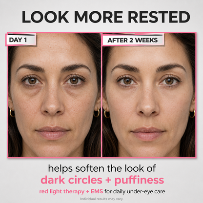 Under-Eye Red Light Beauty Device – Gentle LED Eye Care for Tired-Looking Eyes