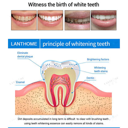Best Sellers 50% off - Teeth Whitening Essence