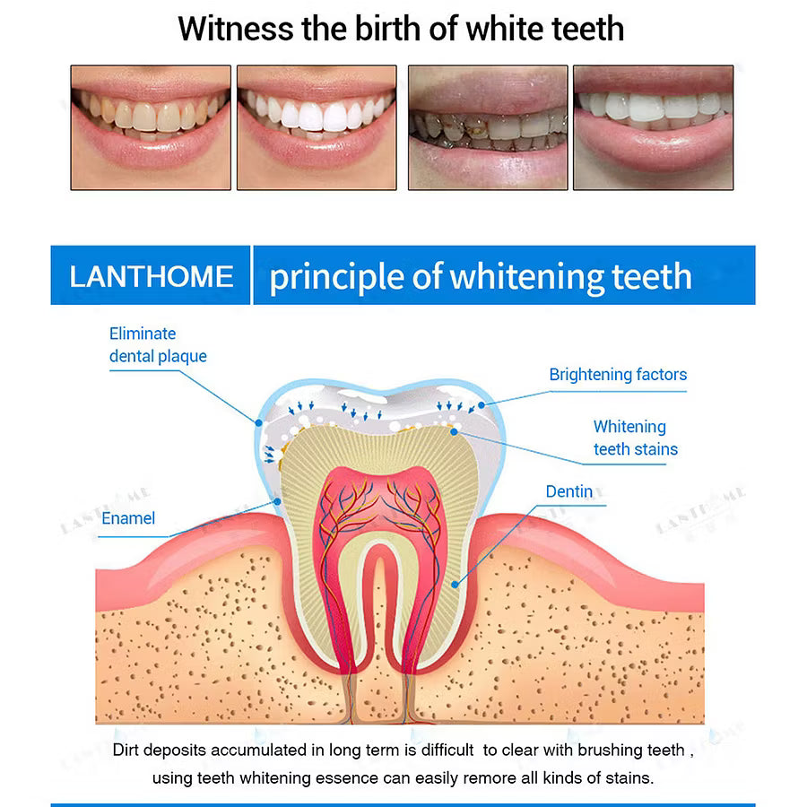 🔥Best Sellers 49% off - Teeth Whitening Essence