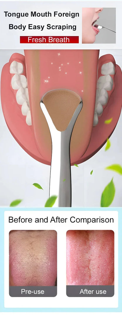 ✨Stainless Steel Tongue Scraper🚚Cash on Delivery