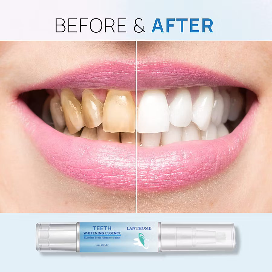 🔥Best Sellers 49% off - Teeth Whitening Essence