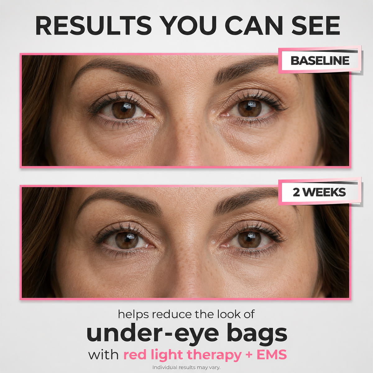 Under-Eye Red Light Beauty Device – Gentle LED Eye Care for Tired-Looking Eyes