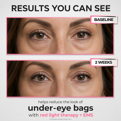 Under-Eye Red Light Beauty Device – Gentle LED Eye Care for Tired-Looking Eyes