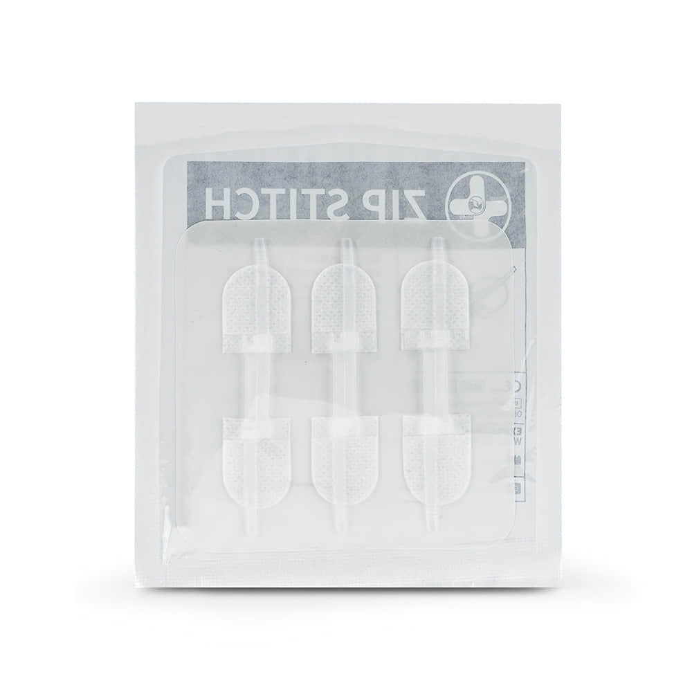 Wound Closure Device