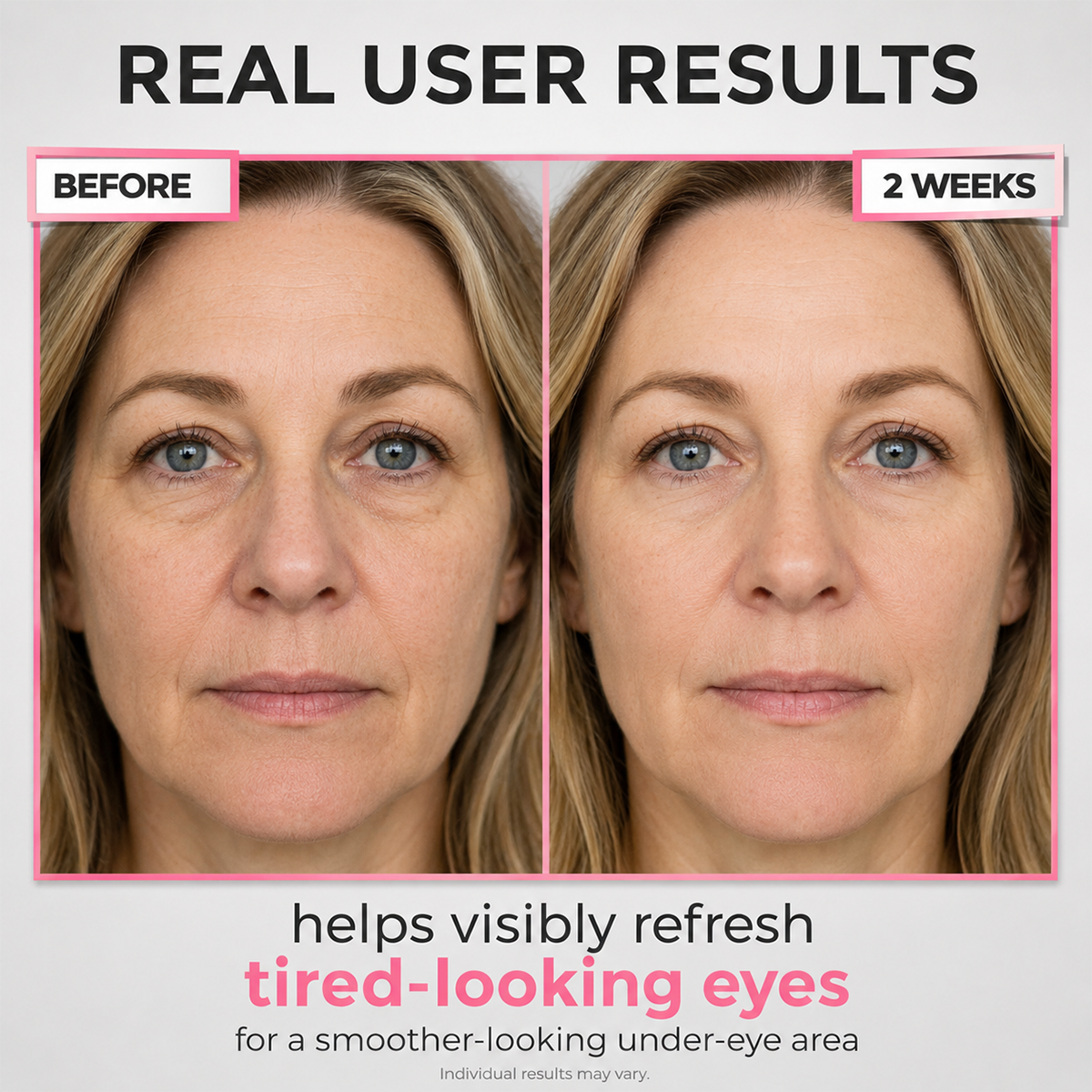 Under-Eye Red Light Beauty Device – Gentle LED Eye Care for Tired-Looking Eyes