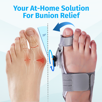 Bunion Corrector – Adjustable Toe Alignment Support for Daily Comfort