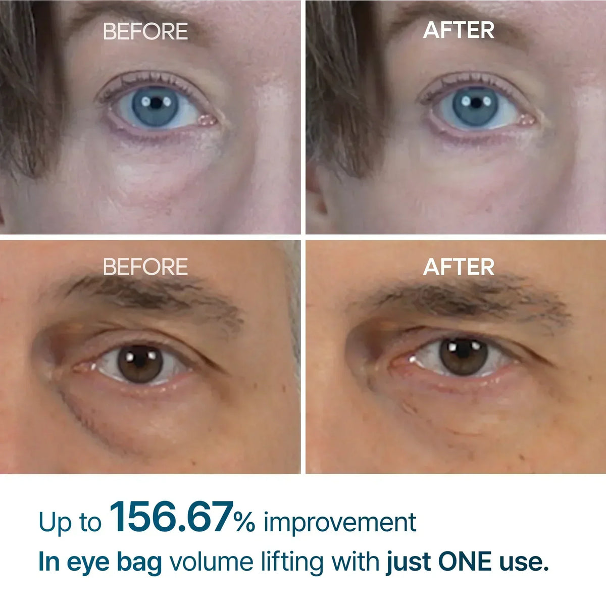 Eyebag Remover Cream