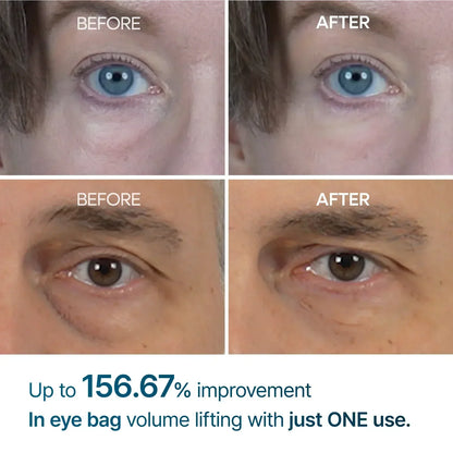 Eyebag Remover Cream