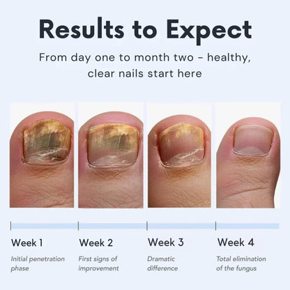 Antifungal Nail Pen | Extra Strength Toenail Fungus Treatment & Repair Solution💯