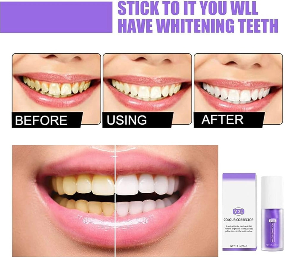 1+1 FREE I V34 Colour Corrector | Feel more confident with a fresh, radiant smile that lasts