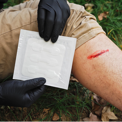 Wound Closure Device
