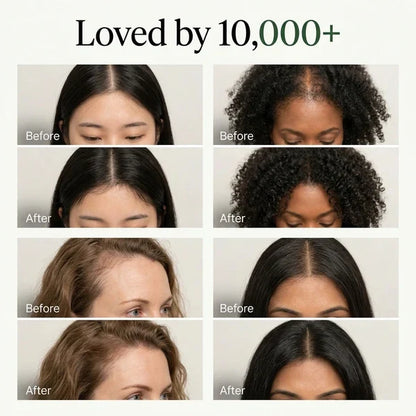 Herbal Skglm™ Thicker, Fuller, Darker Hair Bar