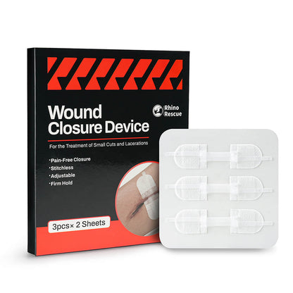 Wound Closure Device